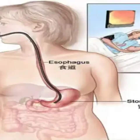 胃镜检查健康宣教