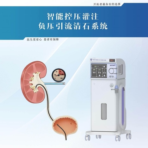 智能控压灌注负压引流清石系统（泌尿外科专用）