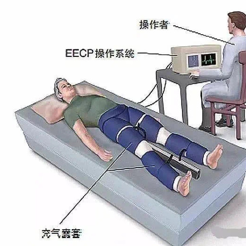 体外反搏，搏出健康