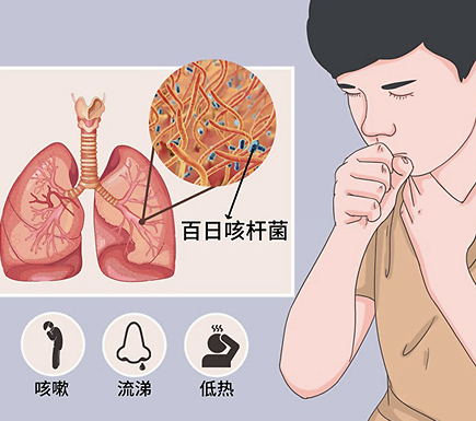 科学预防百日咳 认识百日咳——春季校园常见疾病预防知识宣传百日咳篇