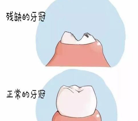 【章丘逸乐医院】别小看牙体缺损，它可能正在悄悄破坏你的健康