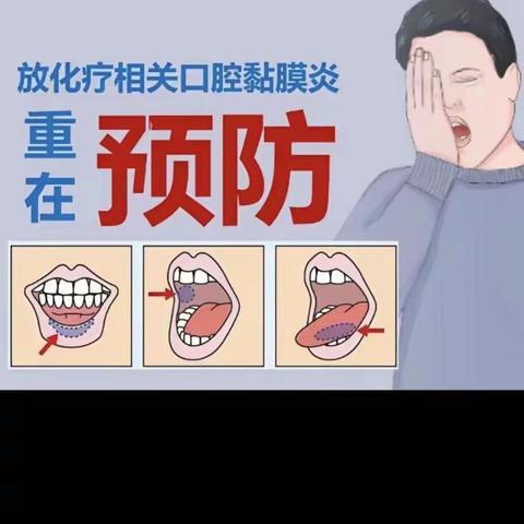 放化疗相关口腔粘膜炎的预防和护理。