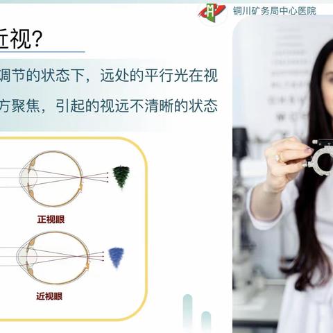 铜川矿务局中心医院眼科小讲堂｜护眼小常识-近视 1